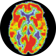Lit up image of a brain scan