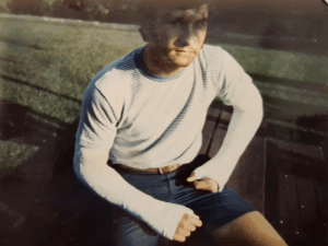 Former NFL quarterback and Legacy Donor Bill Demory with casts on his arms